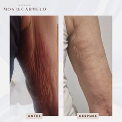 Clínica Montecarmelo