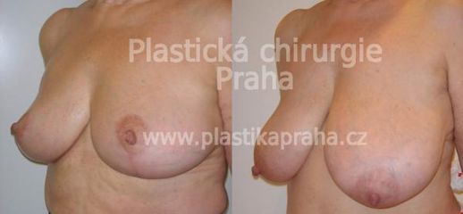 predapo (11)