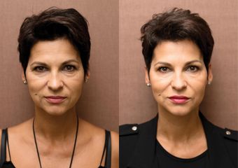 ANTIAGING PRED PO 008