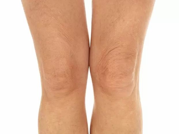 Hyaluronsäure für Knie