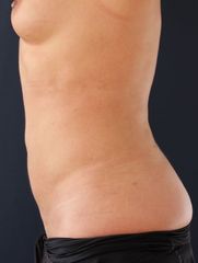 fetta1