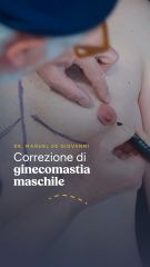 Dott. Manuel De Giovanni Foto relativa al servizio ginecomastia
