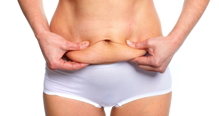 Adipositaschirurgie: Welche Vorteile bringen die Straffungsoperationen?