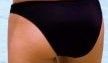 Body Contouring. Was ist das?