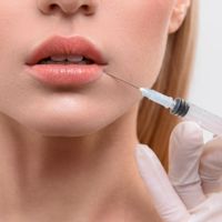 Botox bei Bruxismus – Eine sinnvolle Therapieoption