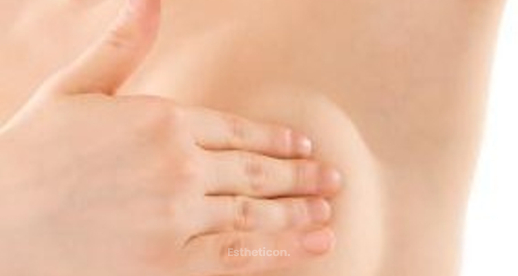 Brustrekonstruktion