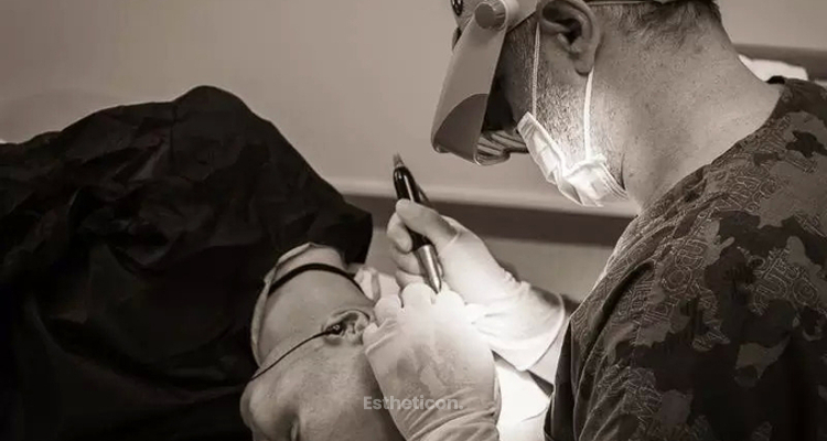 Dr. Erkan Demirsoy, der FUE-Spezialist: Überzeugende Erfahrungen von Patienten