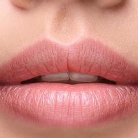 Kennen Sie die Lippenverkleinerung?