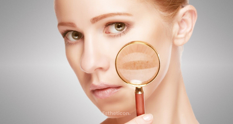 Laser Skin Resurfacing bei hyperpigmentierter und gealterter Haut