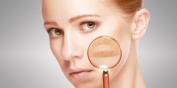 Laser Skin Resurfacing bei hyperpigmentierter und gealterter Haut