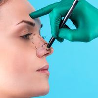 Nasenkorrektur – Damit Ihre Nase zu Ihrem Gesicht passt