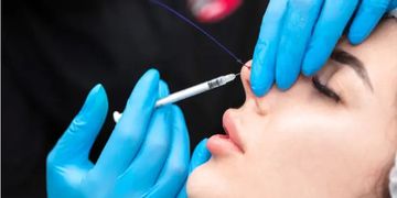 Nasenkorrektur ohne Operation – Eine realistische Bewertung