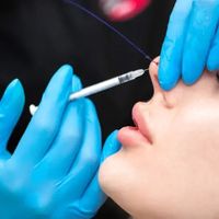 Nasenkorrektur ohne Operation – Eine realistische Bewertung