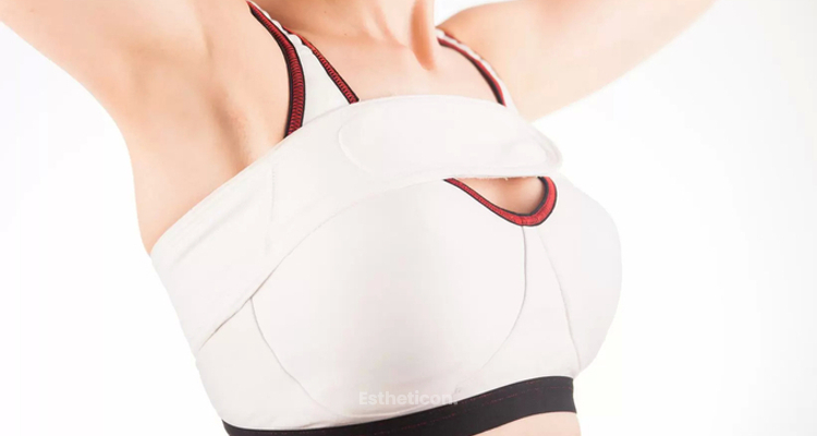 Optimale Implantatlage & sportliche Aktivitäten nach der Brustvergrößerung