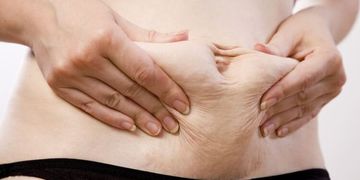 Wie lassen sich hartnäckige Fettpolster durch Lipolyse entfernen?