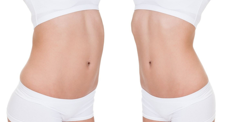 Schönen flachen Bauch bekommen
