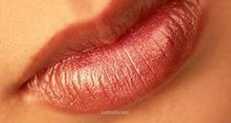 Sollte man die Lippen mit Hyaluronsäure, oder Botox vergrößern?