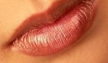 Sollte man die Lippen mit Hyaluronsäure, oder Botox vergrößern?