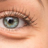 Wirksam Augenringe entfernen - Blepharoplastik, Laser oder Hyaluronsäure?