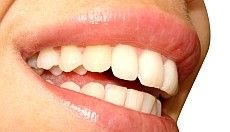 Zahnfleischkorrektur - Teil 4 unserer Zahnmedizinserie