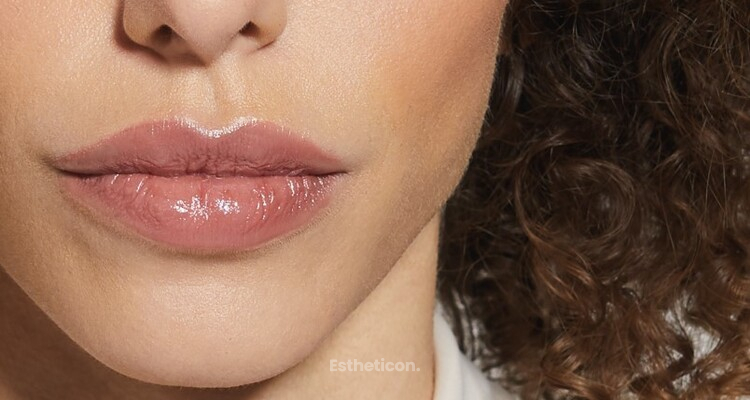 Lippenvergrößerung 2021 - Konturierung, Projektion und Langlebigkeit in einem HA-Filler