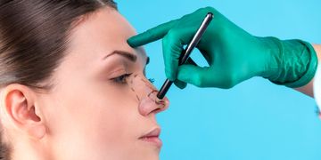 Sattelnase: Wie sich die Nasendeformität behandeln lässt