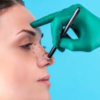 Sattelnase: Wie sich die Nasendeformität behandeln lässt