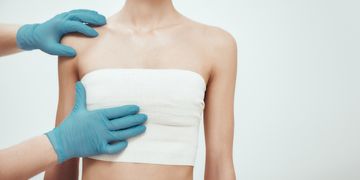 Inzisionen bei Brustvergrößerungen - Häufige Platzierung der Schnittführung