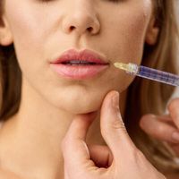 Lippen aufspritzen: Dein Guide zu vollen Lippen nach deinen Wünschen