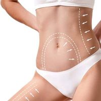 Körperformung mit Fettabsaugung und Eigenfetttransplantation