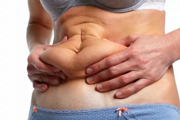 Bauch vor Fettabsaugung