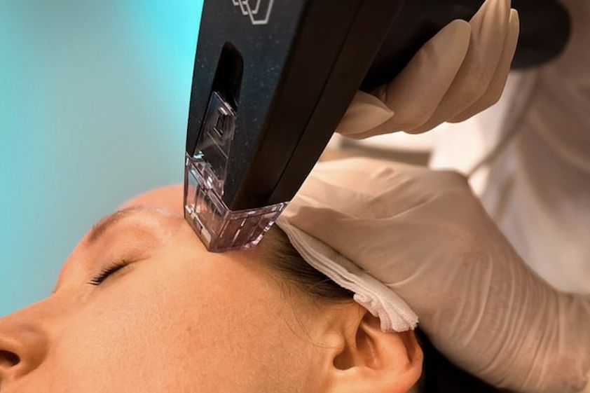 Anti-Aging resultate - 868555