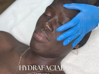 Botox resultate - 877301