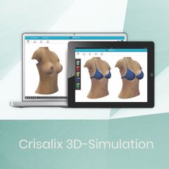 crisalix-3d-simulation-vor-brust-op