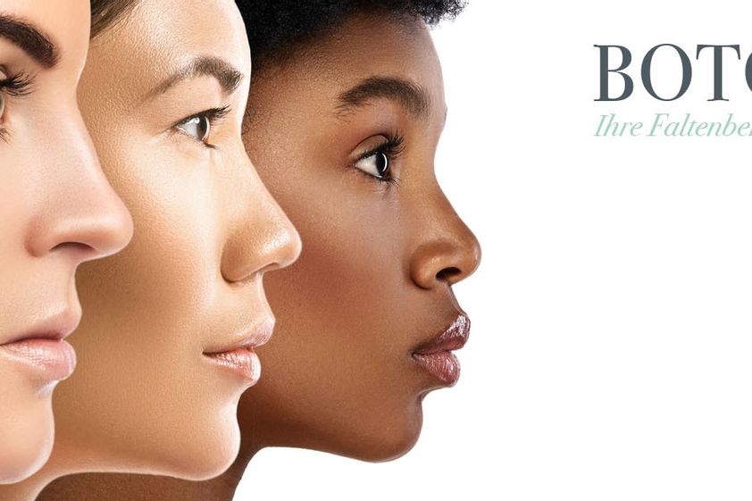 Botox resultate - 870691