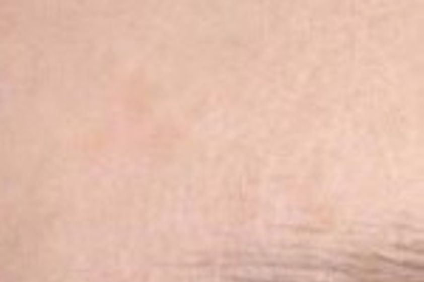Anti-Aging resultate - 780523