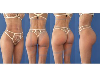 Po Implantate - Dr. Alexander T. Hamers