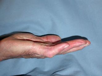 Handchirurgie resultate - 779093