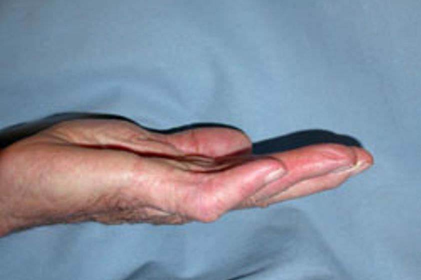 Handchirurgie resultate - 779093