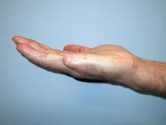 Handchirurgie resultate - 779094