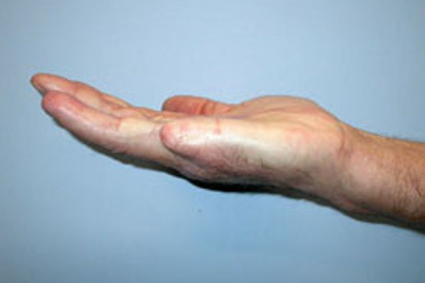 Handchirurgie resultate - 779094