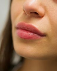 Lippenunterpritzung von Dr. Alt
