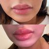 Fantastische Lippen