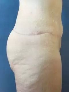 117278