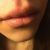 Wunderschöne Lippen mit Hyaluronsäure und unendlich dankbar