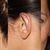 Earfold Ohrenkorrektur: mehr als zufriedenstellendes Ergebnis