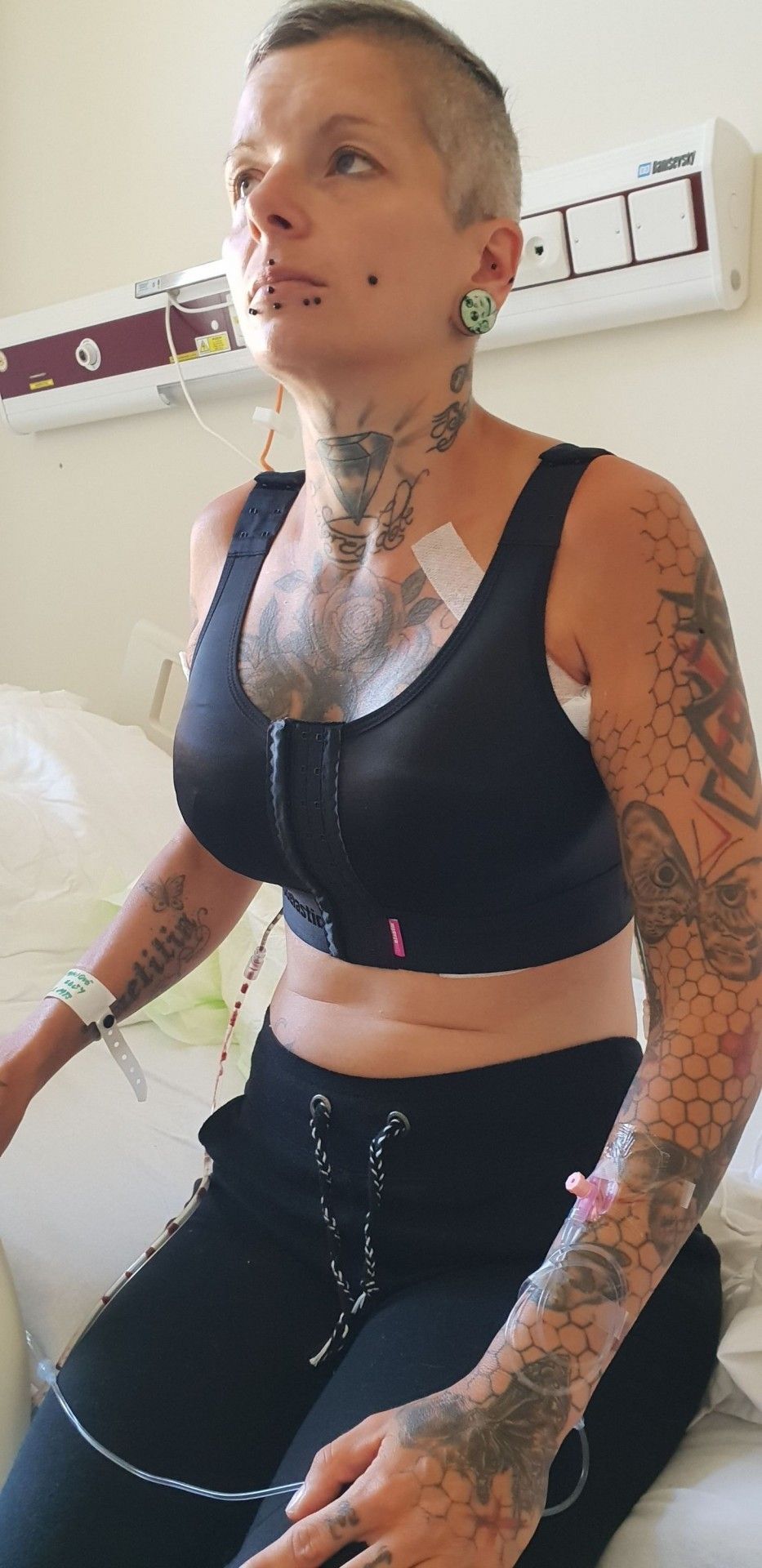 Sympathisch und professionell,Brustvergrösserung mit 360 ml Implantaten und Straffung, auf C Sympathisch und professionell,Brustvergrösserung mit 360 ml Implantaten und Straffung, auf C