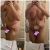 Bodylift mit Entfernung von 2,5 kg Haut: ganz okay