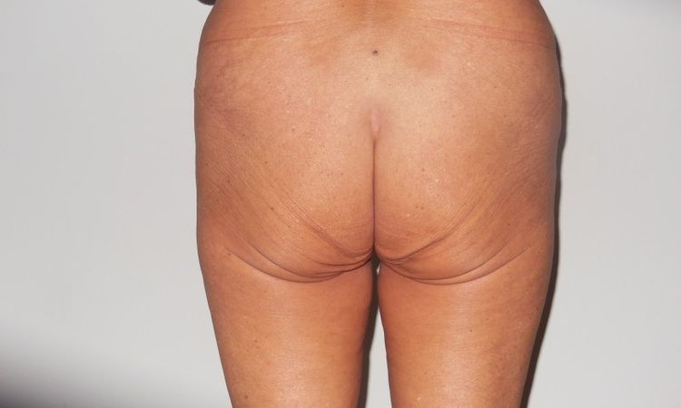 115729