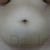 Liposuktion by a really competent and professional Doctor!!!!